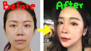 Somasundaram sathappan is a plastic and reconstructive surgeon and heads the soma plastic surgery (clinical aesthetics) clinic in subang jaya, malaysia. Malaysian Girl Chenelle Re Visits Id For Another Plastic Surgeries Youtube
