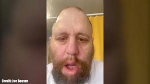 Scot suffers a partially paralysed face as docs suspect he may have very  rare form of cancer