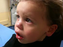 Oliver. Post stitches.