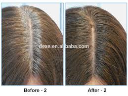 Root erase is the 2019 winner of allure's best of beauty award for root coverage/hair color. Dexe Cover The Grey Root Color Dye Waterproof Ingredient Powder For Highlight Hair Root Powder Buy Non Toxic Hair Color Dye Non Toxic Hair Color Dye Non Toxic Hair Color Dye Product On Alibaba Com