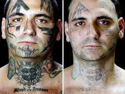 In fact, your body responds to the treatment by working in conjunction with the laser to help speed the process along. Fda Tattoo Removal No Simple Process Cbs News