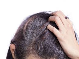 Melanin is responsible for the color of hair you're born with, which is based the odds of premature graying depend on how your hair follicles produce melanin. Grey Hair Home Remedies How To Get Rid Of Grey Hair Naturally