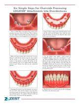 We did not find results for: The Chairside Attachment Processing Material Zimmer Dental Pdf Catalogs Technical Documentation