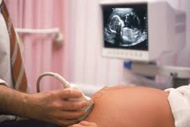 An ectopic pregnancy can be difficult to diagnose in its early stages. 20 Week Scan Nhs