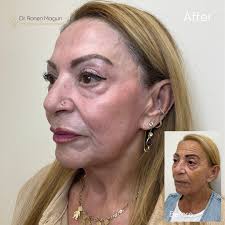 דר רונן מגון