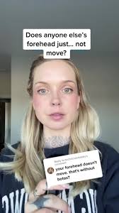 Why Doesn't My Forehead Move? The Mystery Explained