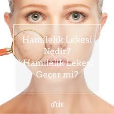 Hamilelik Lekesi Nedir Hamilelik Lekesi Gecer Mi Hamilelik Kadin Fotograf Cekimi