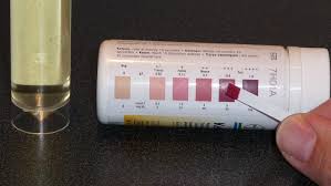 11 Detailed Ketone Test Strip Color Meaning