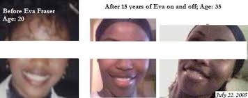 If you could've started early, which facial ex program?