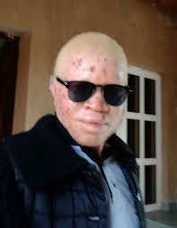 I USE THIS MEDIA TO SENT MY CONDERLESS TO COE KANGERE AND DEPARTMENT OF  ADULT EDUCATION ON LOST ONE OF OUR LECTURER MAL AHAMED JAHUN HE WAS TAKEN  US ADIO VEDUAL MATERIAL