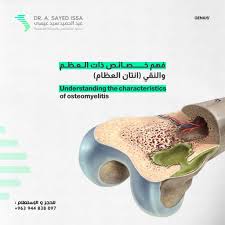 Image result for Osteomyelitis