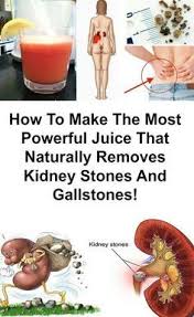 Pin On Juicing Cures