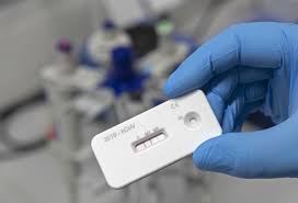 New L A Antibodies Study Explores Coronavirus Spread Los Angeles Times