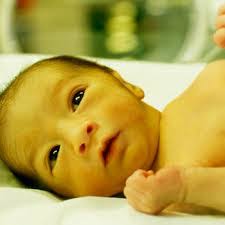Penyakit ini sering dikenal juga sebagai jaundice. 7 Penyebab Bayi Kuning Baru Lahir Hamil Co Id