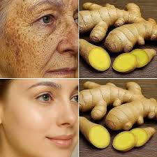 Ginger is 100 times more powerful than Botox in removing deep wrinkles,  freckles and dark spots Must express something to keep getting my  recipes.... Thank you Recipe in (c.o.m.m.e.n.t ).