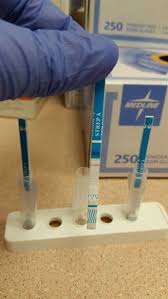 Strep Testing A Swab Of The Throat Is Sent To The Lab Mixed With Bottles Of Liquid Causing A Reaction To Occur Reagents W Strep Throat Medical Care Career