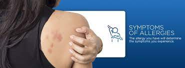 Can Allergies Affect Joint Pain Orthobethesda