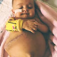 Fundraiser by Mia Barlow : Nova's fight with Biliary Atresia