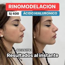 🛑 Plasma gel en glúteos x solo 400 soles 🗓️atendemos previa cita 📬 SEDE  CENTRO JR Huallaga 288/ tercer piso 309 al costado de la Catedral de Lima  📫 SEDE MIRAFLORES Calle
