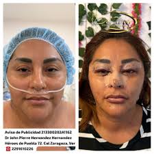 DrJohn Pierre Hernandez Hernandez (@drpierreffect) • Instagram photos and  videos