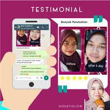 Haaa.sis tengok sendiri jadi ke tak. Free Postage Sabun Honey Glow Gold Shopee Malaysia