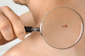 Undertaken to reduce the increasing deaths related to. Artificial Intelligence System To Help Detect Skin Cancer