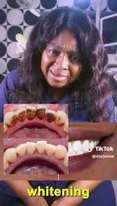 TeethCare., Credit; Tiktok