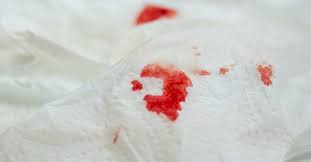 خونریزی مقعدی برای چیست؟