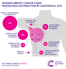 Find out about secondary breast cancer in the brain (also called brain metastases or brain mets), including treatment and controlling symptoms. Breast Cancer Incidence Invasive Statistics Cancer Research Uk