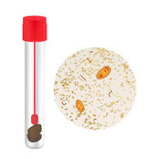 Do you have to study at specific times or can you work through the course in your own time? Stool Tests Types Purpose Procedure Result Interpretation