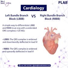 Image result for Left Bundle Branch Block