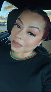 Gabriela Salgado Injury Picture