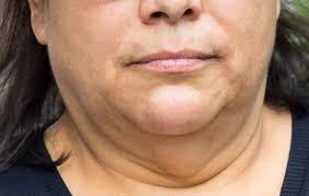 Learn how to lose weight by changing how you think about eating carbs. How To Lose Weight In Your Face What You Can Do About Facial Weight Gain Women S Health