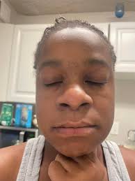 Anyone know what this weird dark spot is