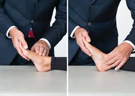 Image result for Ankle External Rotation Test