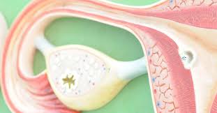 If it is cancer, there's information. Ovarian Cancer And Cysts What Is The Link