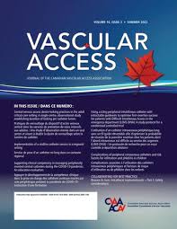 Image result for Difficult Intravenous Access in Children