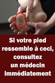 Pin On Trucs Et Astuces