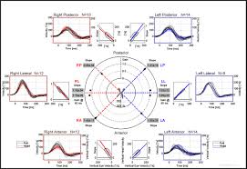 Image result for Horizontal Head Impulse Test