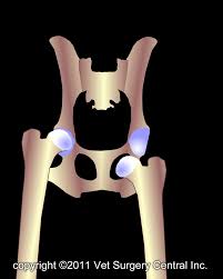Image result for Hip Dislocation