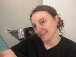 Hi! I got my brow pierced 9 weeks ago and just had the bar sized down  today. It healed great.. but then I just found out I may either have to take