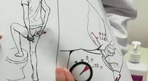 You can get more information from the official website. Covid 19 Coronavirus China Starts Using Anal Swabs To Test High Risk People For Virus Nz Herald
