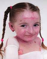 Great Lakes Society of Diabetes and Endocrinology