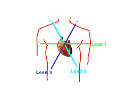 Ecg Primer The Mean Electrical Axis