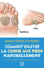 Soigner cors au pied huile essentielle enlever un cor au pied soi meme comment se.dans cet article, nous voulons partager avec. Epingle Sur Beaute