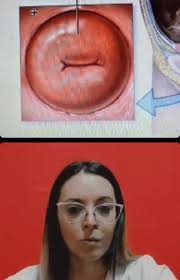 Lorena Soria y Elisa Cinella , Ginecólogas de la institución nos cuentan de  la importancia que tiene el Papanicolaou en la prevención del Cáncer de  cuello de Útero💜👆🏻