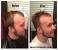Thinning Shears Hair Thinning Before And After