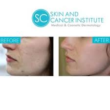 Top 10 Best La Laser And Skin Center In Modesto Ca Last Updated November 2020 Yelp