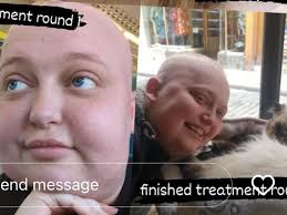 Fundraiser by Michelle Flood : Help for zoe