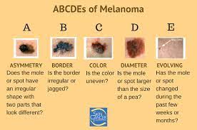 Learn more about targeted therapy, surgery, and chemotherapy. Https Www Coloradocancercoalition Org Wp Content Uploads 2018 05 Melanoma2fskin Cancer Awareness Month 2018 Final Pdf